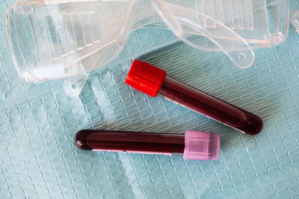 Health check-up and lab tests